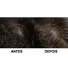 anticaspa antes depois 02
