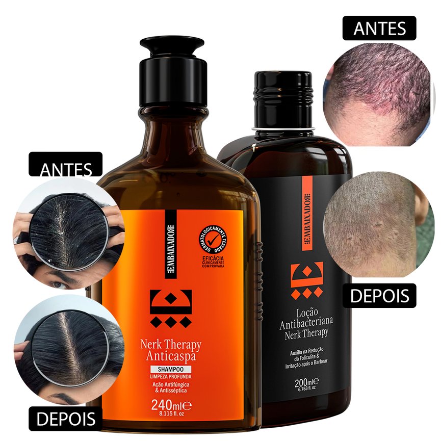 kit 01 lo 1 sham prova